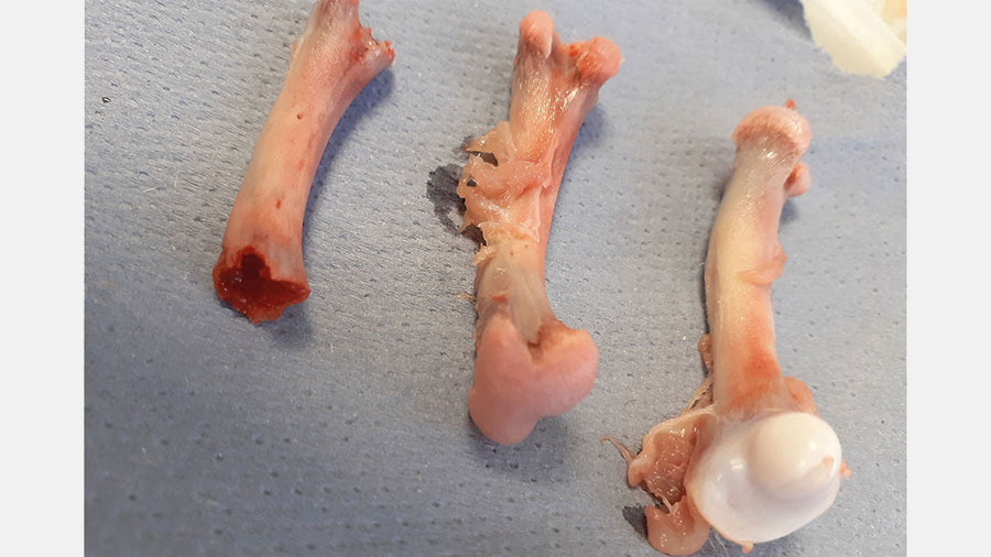 Three femur-bones left to right: femoral head necrosis, detatched femoral head cartilage, healthy femoral