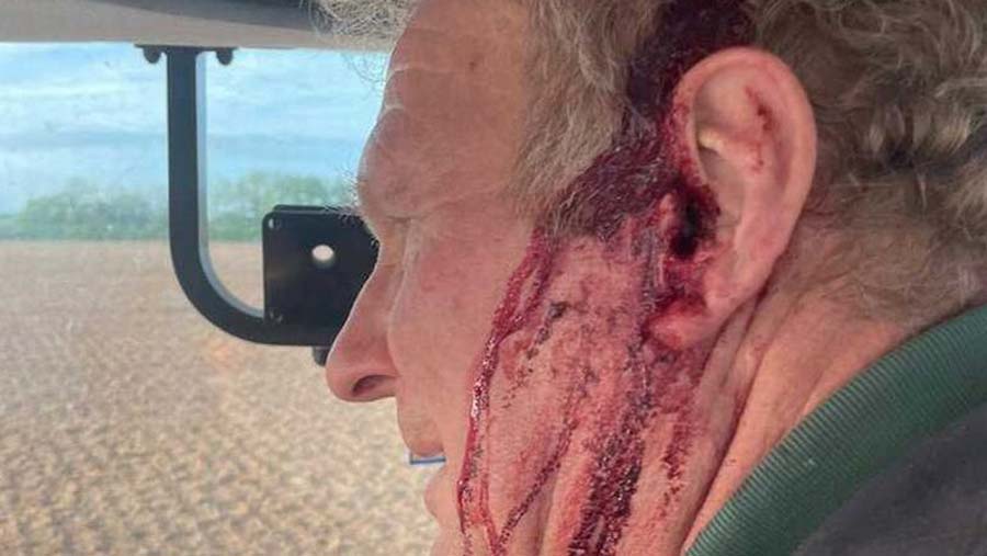 Farmer Christopher Pine after the attack © BPM Media