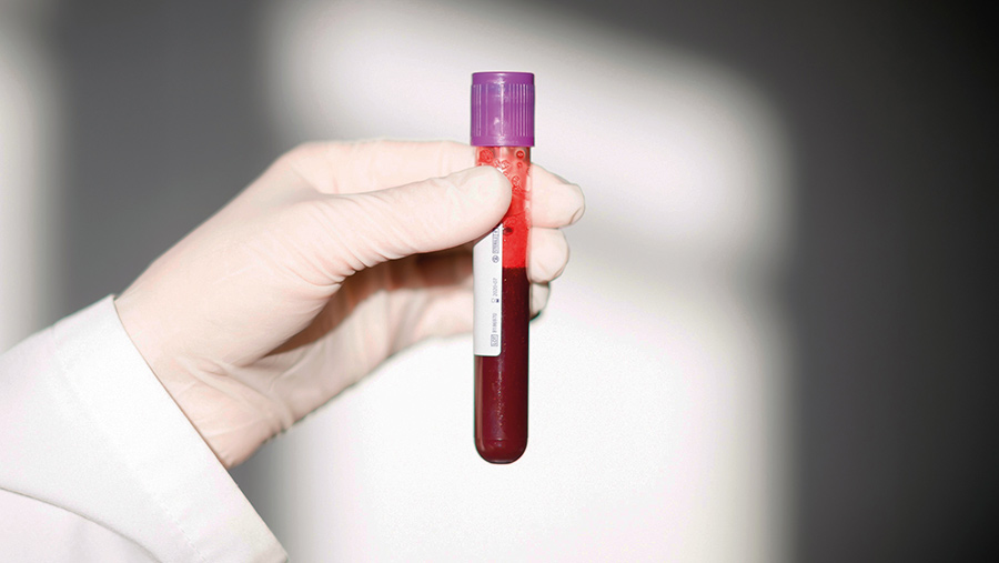 Blood sample in a test tube
