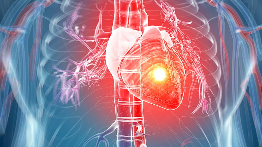 Surviving heart attack: 'Reading Farmers Weekly saved my life' - Vimarsana News
