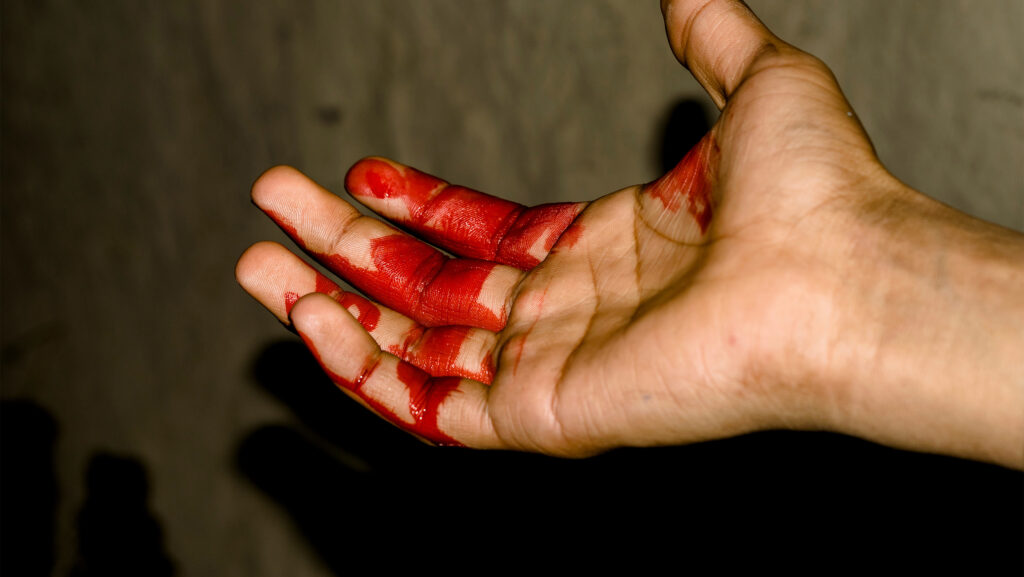 Blood-stained hand