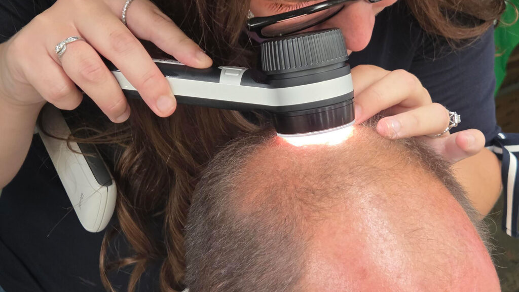 A skin cancer check