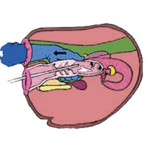 Diagram showing how to know when the cow's cervix has been reached